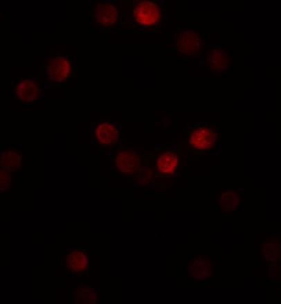a04530 gemin2 primary antibodies if testing 3