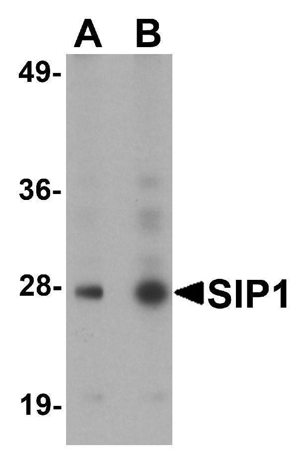 a04530 gemin2 primary antibodies wb testing 1