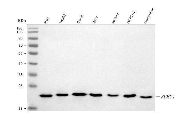  Western blot analysis of Pirh2/RCHY1 using anti-Pirh2/RCHY1 antibody (A04533-3)