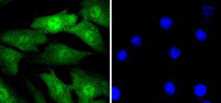 ICC staining Cyclin E2 in NIH/3T3 cells (green)