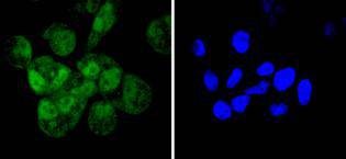 ICC staining Cyclin E2 in Hela cells (green)