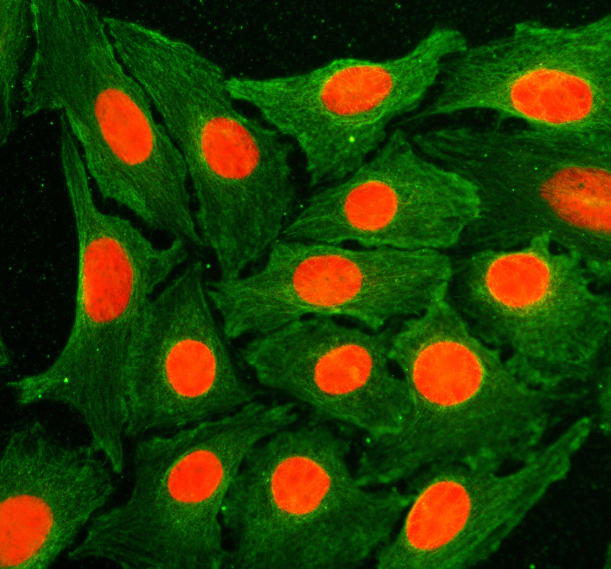 a04536 3 ccne2 primary antibodies if testing 1