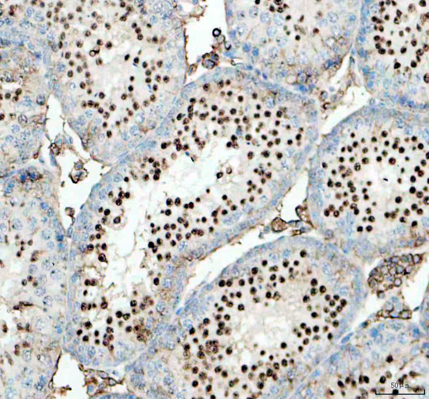 a04536 3 ccne2 primary antibodies ihc testing 1
