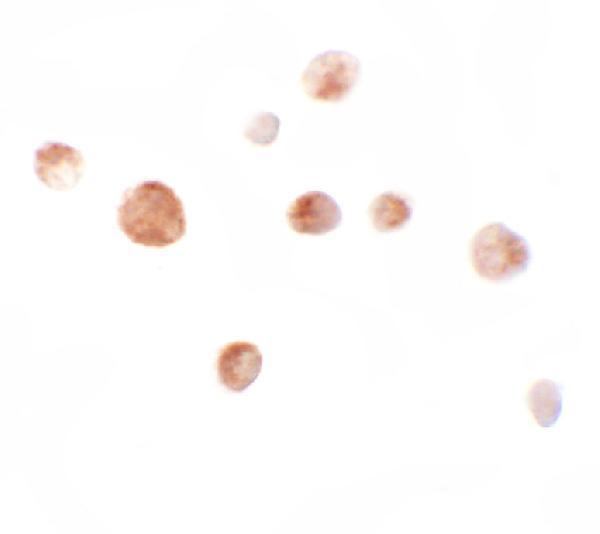 Immunocytochemistry of ZIMP10 in K562 cells with ZIMP10 antibody at 10 μg/mL