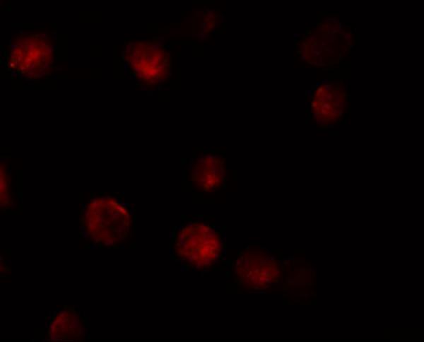 Immunofluorescence of ZIMP10 in K562 cells with ZIMP10 antibody at 20 μg/mL