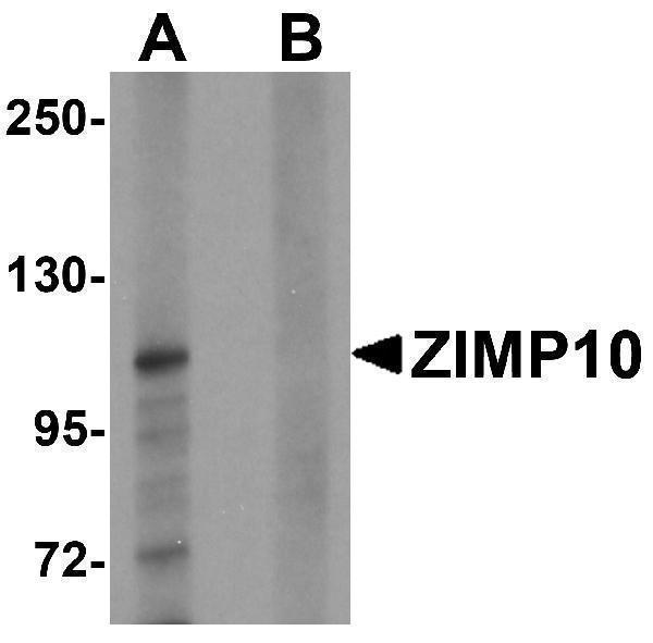 Western blot analysis of ZIMP10 in K562 cell lysate with ZIMP10 antibody at 0