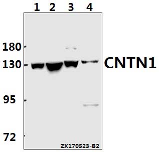 Western blot (WB) analysis of CNTN1 polyclonal antibody at 1:500 dilution
Lane1:A549 whole cell lysate(40ug)
Lane2:HEK293T whole cell lysate(40ug)
Lane3:C6 whole cell lysate(40ug)
Lane4:MEF whole cell lysate(40ug)