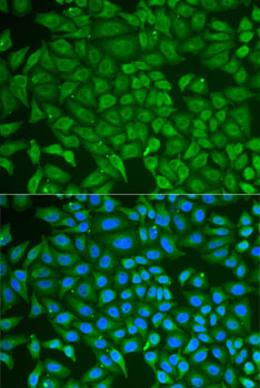 Immunofluorescence analysis of U2OS cells using PIP antibody 