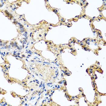 Immunohistochemistry of paraffin-embedded human prostate using PIP antibody  at dilution of 1:100 