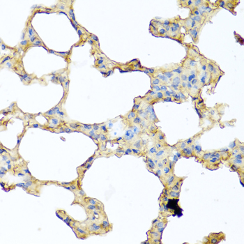 a04543 pip primary antiboties ihc testing 3