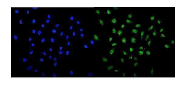 a04545 1 med13 primary antibodies if testing 2