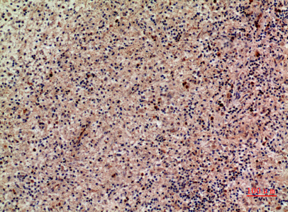 Immunohistochemical analysis of paraffin-embedded human-liver, antibody was diluted at 1:100