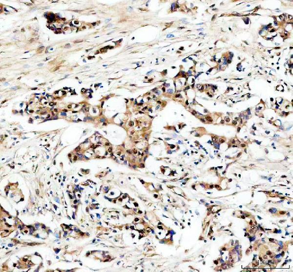 IHC analysis of USP5 using anti-USP5 antibody (A04550-1)