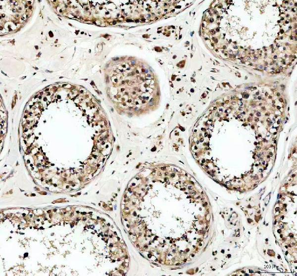 a04550 1 usp5 primary antibodies ihc testing 2