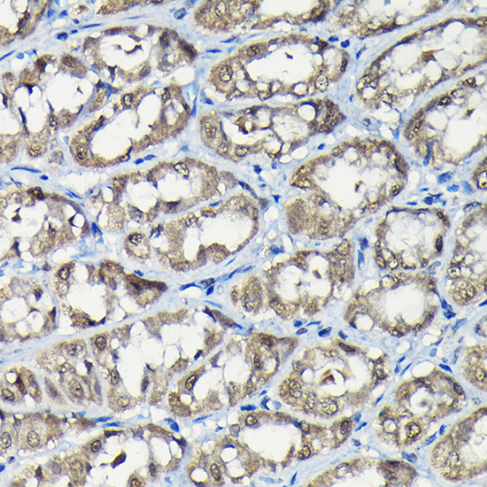 Immunohistochemistry of paraffin-embedded rat stomach using USP5 Rabbit pAb  at dilution of 1:100 