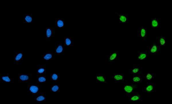 a04551 1 cpsf6 primary antibodies if testing 12