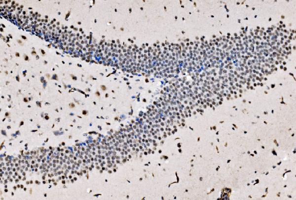 a04551 1 cpsf6 primary antibodies ihc testing 10