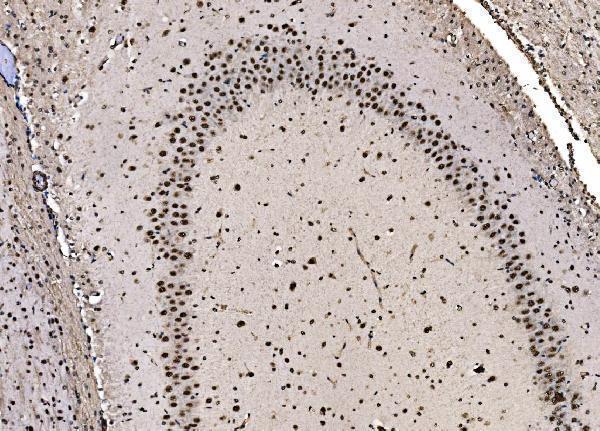 a04551 1 cpsf6 primary antibodies ihc testing 11