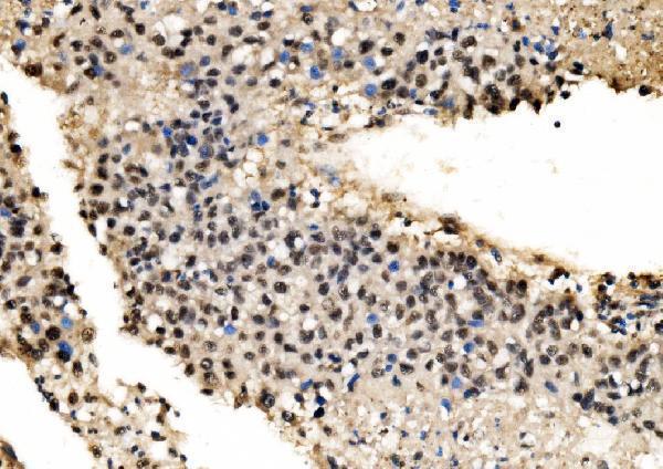  IHC analysis of CPSF6 using anti-CPSF6 antibody (A04551-1)