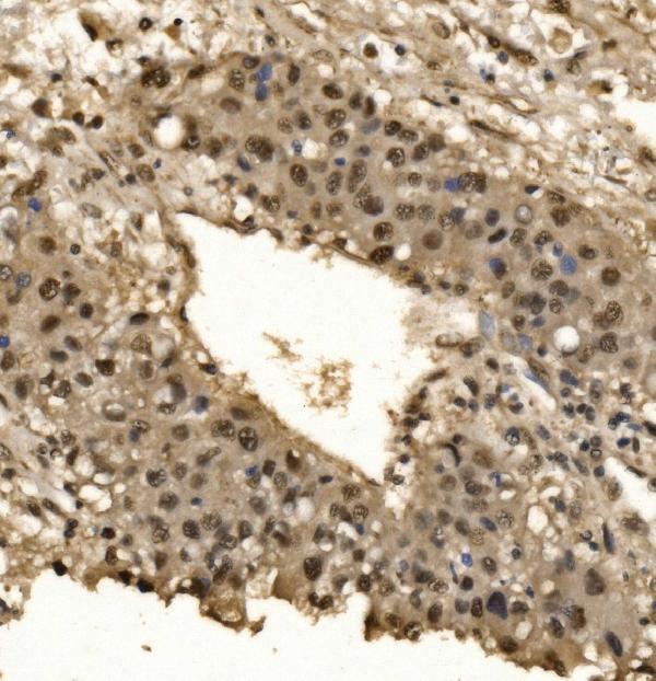  IHC analysis of CPSF6 using anti-CPSF6 antibody (A04551-1)