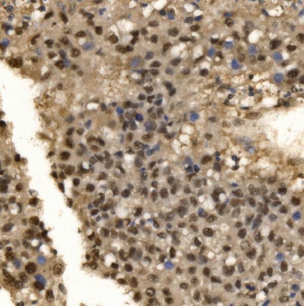 a04551 1 cpsf6 primary antibodies ihc testing 4