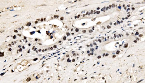 a04551 1 cpsf6 primary antibodies ihc testing 5