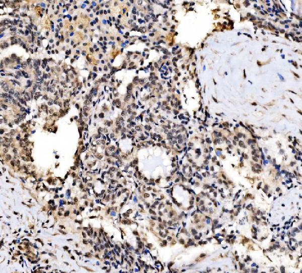 a04551 1 cpsf6 primary antibodies ihc testing 6