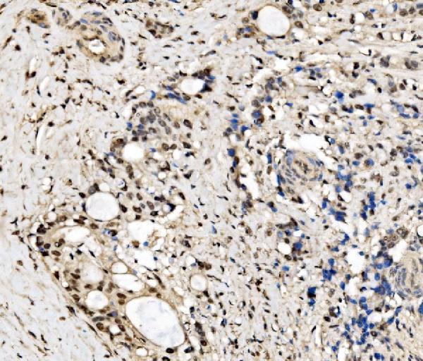 a04551 1 cpsf6 primary antibodies ihc testing 7