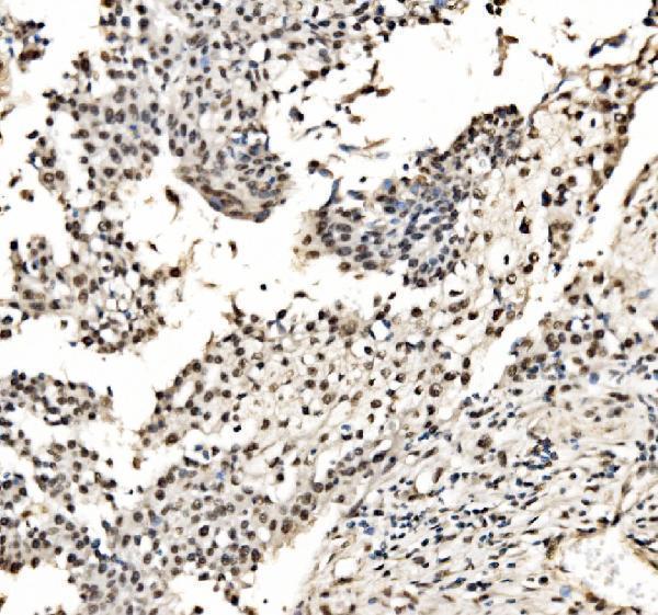 a04551 1 cpsf6 primary antibodies ihc testing 8