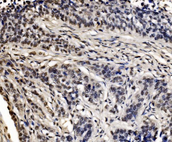 a04551 1 cpsf6 primary antibodies ihc testing 9