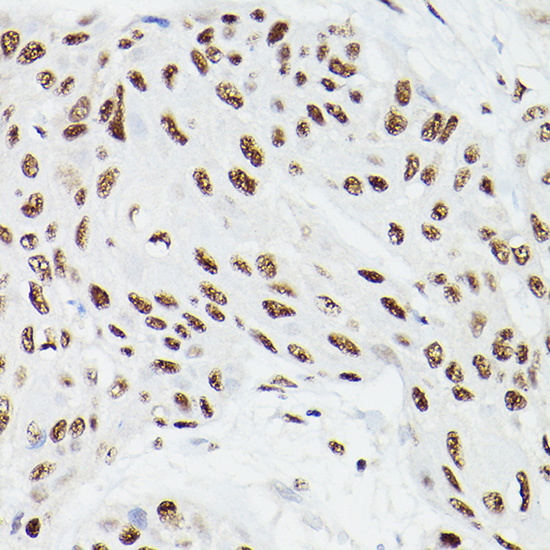 a04551 cpsf6 primary antiboties ihc testing 2