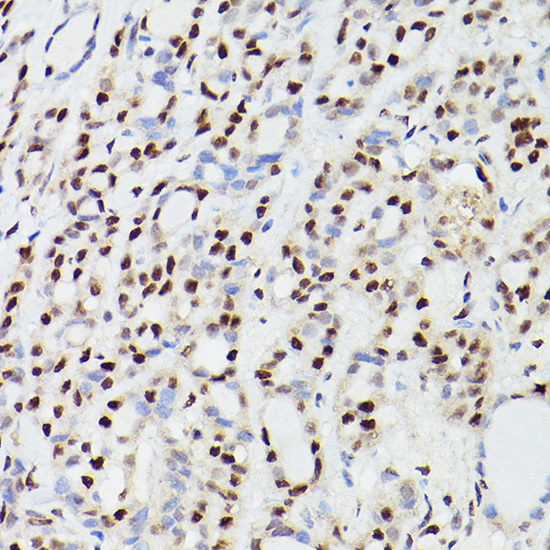 a04551 cpsf6 primary antiboties ihc testing 3