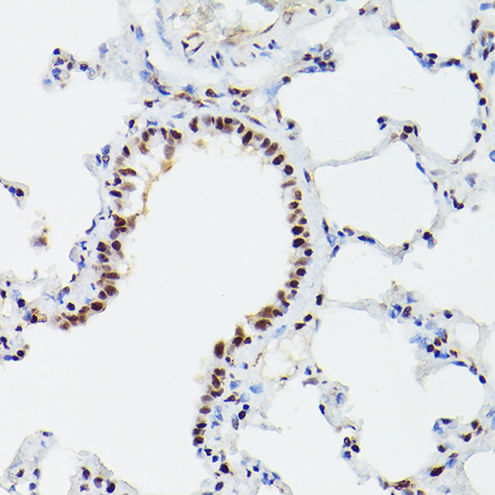 a04551 cpsf6 primary antiboties ihc testing 4