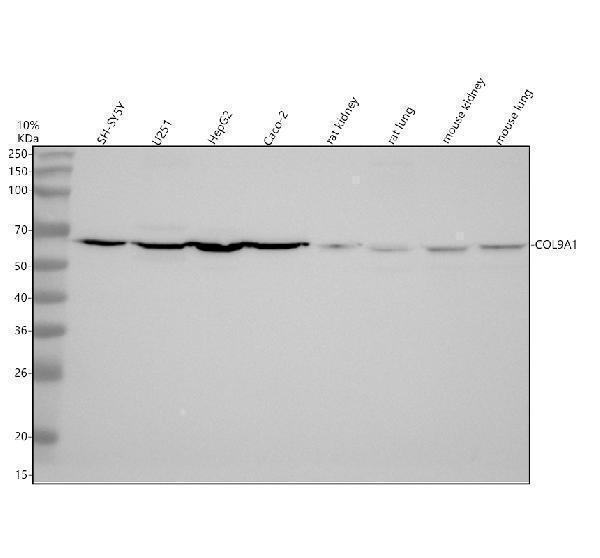 Western blot analysis of COL9A1 using anti-COL9A1 antibody (A04554-3)