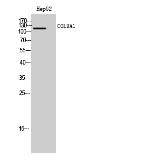a04554 col9a1 primary antibodyes wb testing 1