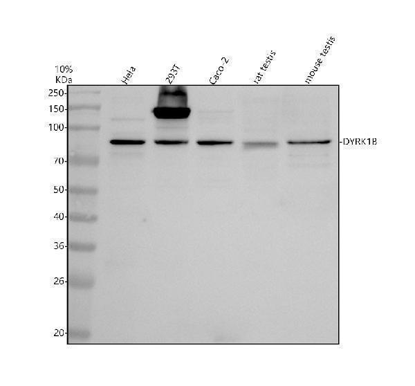 Western blot analysis of DYRK1B using anti-DYRK1B antibody (A04556-1)