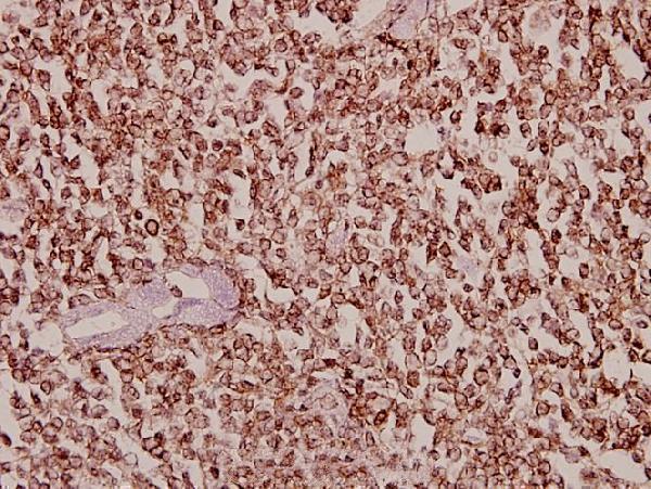 a04556t356 dyrk1b primary antiboties ihc testing 2