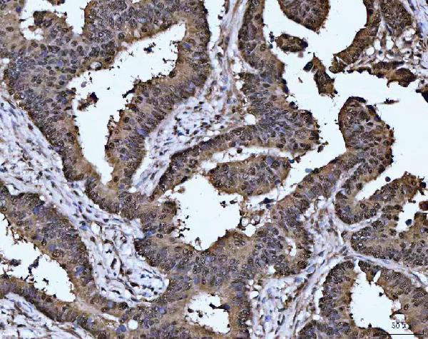  IHC analysis of MAT2A using anti-MAT2A antibody (A04557-1)
