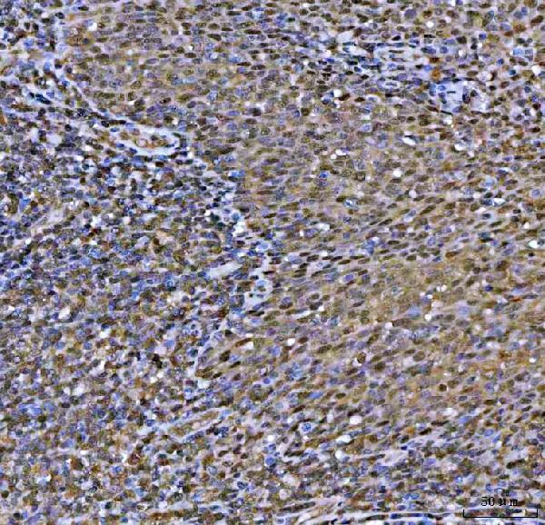  IHC analysis of MAT2A using anti-MAT2A antibody (A04557-1)