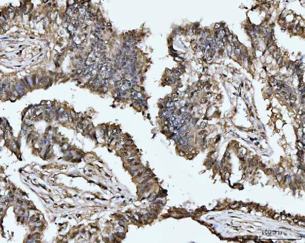 a04557 1 mat2a primary antibodies ihc testing 5