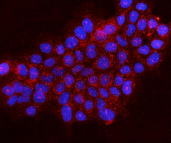 a04560 1 gphn primary antibodies if testing 8