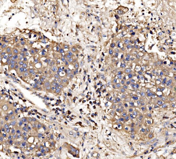 a04560 1 gphn primary antibodies ihc testing 2