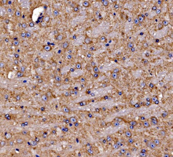 a04560 1 gphn primary antibodies ihc testing 5
