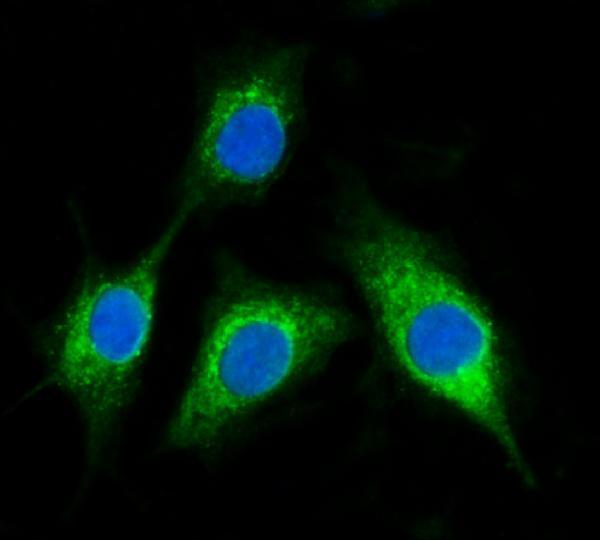 a04561 1 bckdha primary antibodies if testing 13