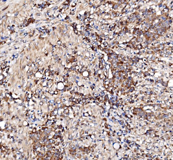 a04561 1 bckdha primary antibodies ihc testing 10
