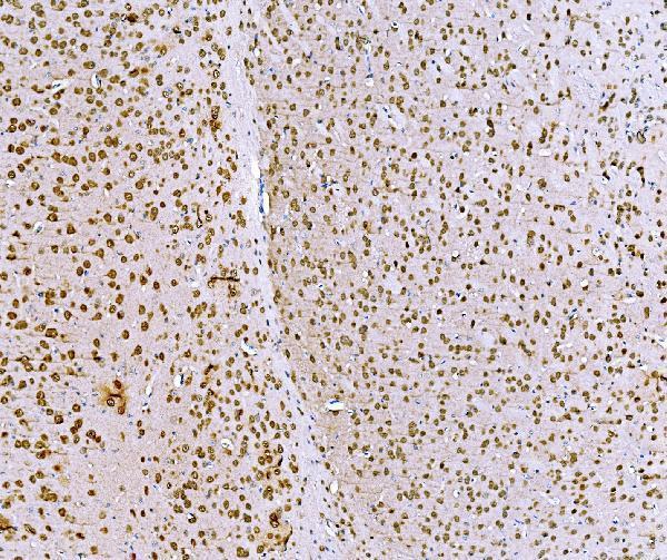 a04561 1 bckdha primary antibodies ihc testing 11