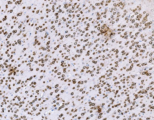 a04561 1 bckdha primary antibodies ihc testing 12