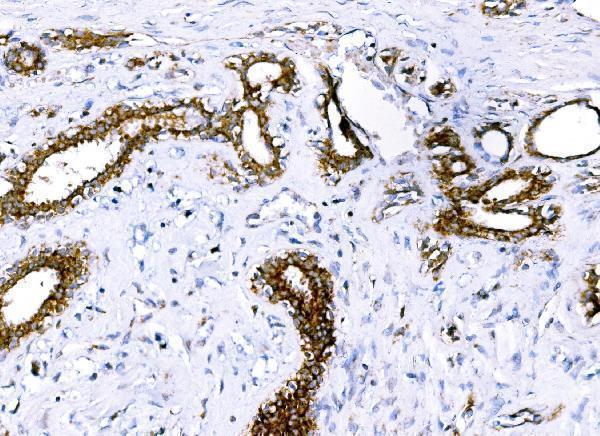  IHC analysis of BCKDHA using anti-BCKDHA antibody (A04561-1)