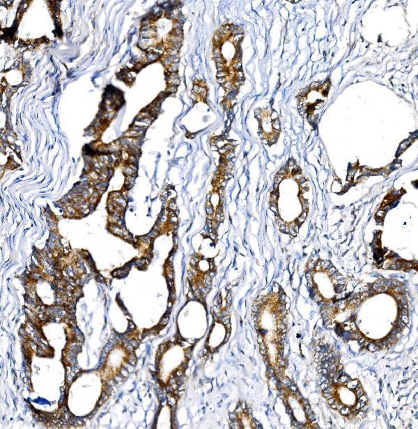  IHC analysis of BCKDHA using anti-BCKDHA antibody (A04561-1)