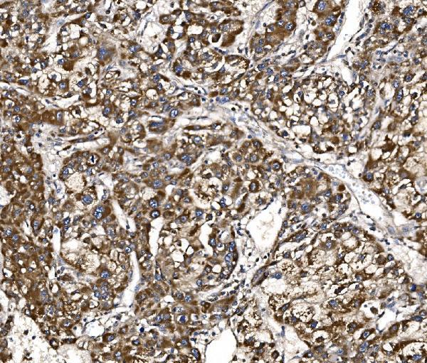 a04561 1 bckdha primary antibodies ihc testing 4